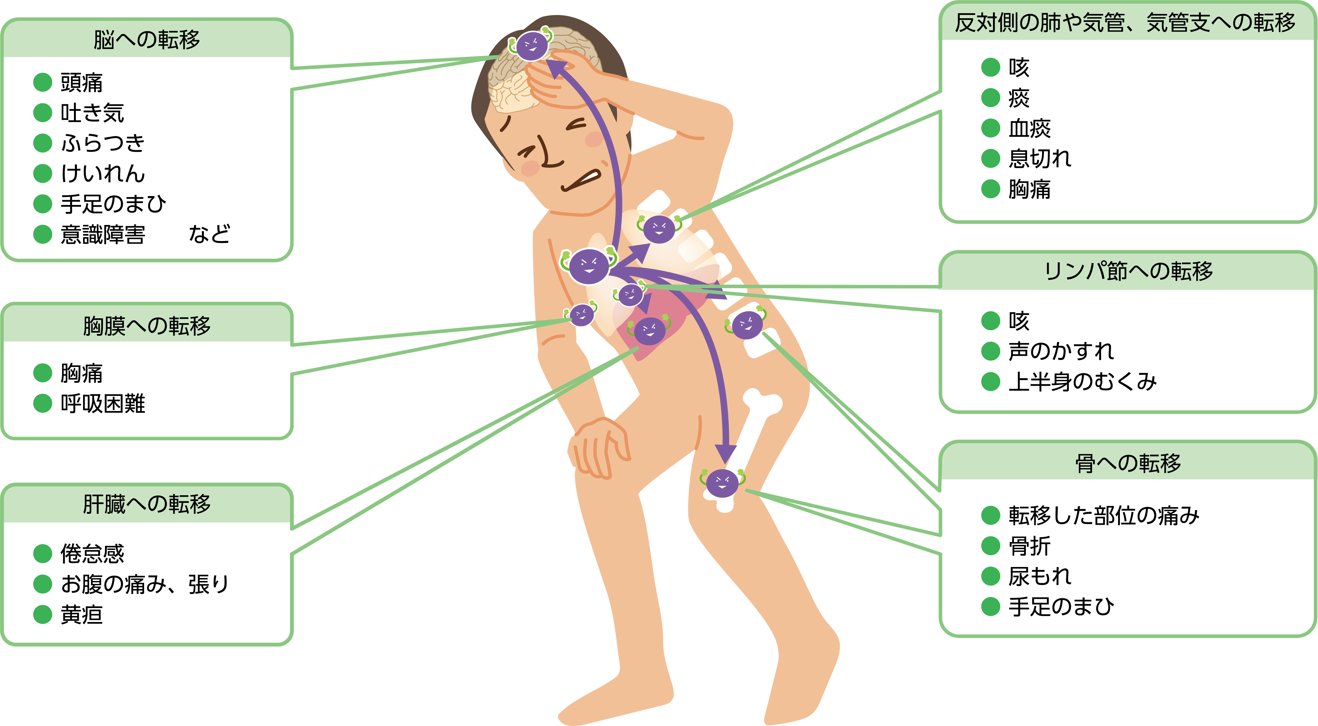 図：転移による症状